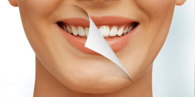 3 мифа об отбеливании зубов