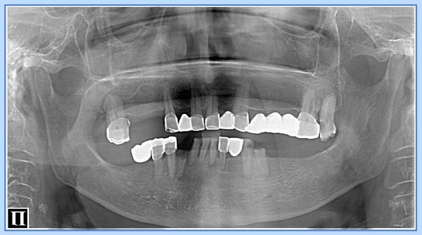 "Зубы V.S. iPhone7" рентгенология, rentgenologia, длиннопост, Картинки, наука, телефон, стоматология, понты