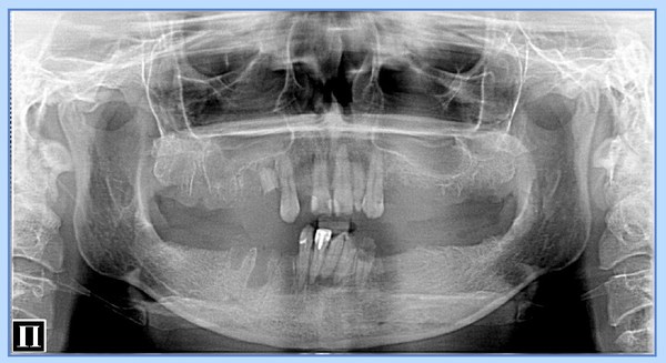 "Зубы V.S. iPhone7" рентгенология, rentgenologia, длиннопост, Картинки, наука, телефон, стоматология, понты