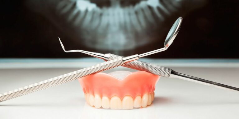 Какие зубные протезы ставить: съемные или несъемные