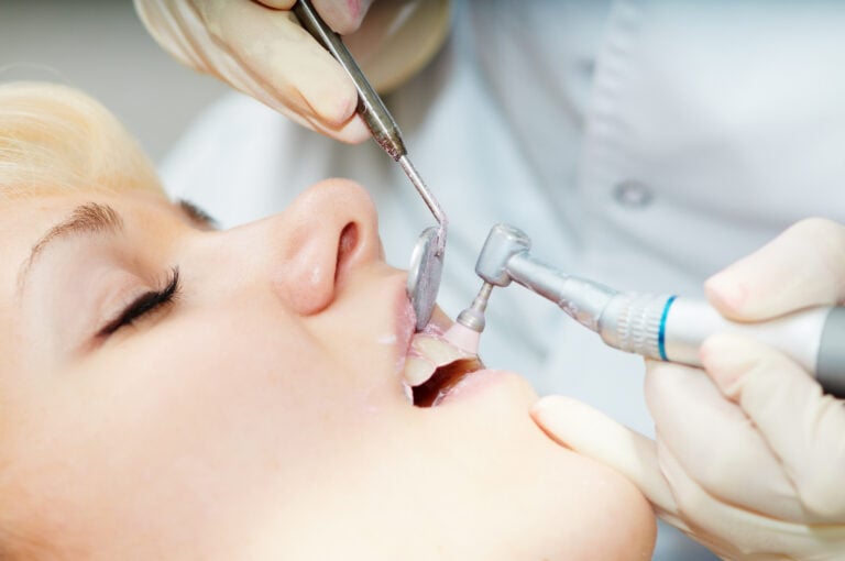 Почему профессиональная гигиена полости рта это не просто «почистить зубы»